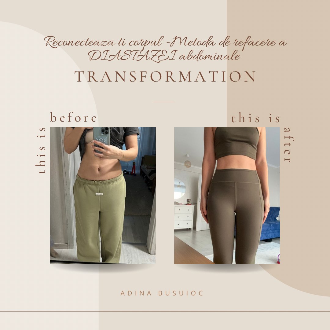 Transformare — refacere diastază abdominală