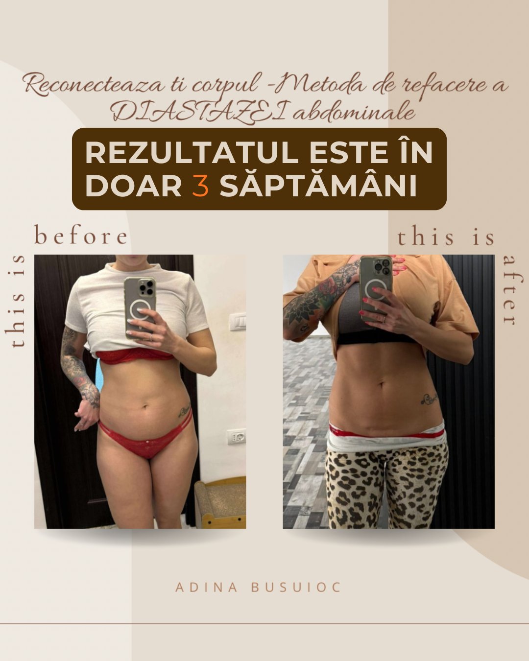 Transformare — refacere diastază abdominală